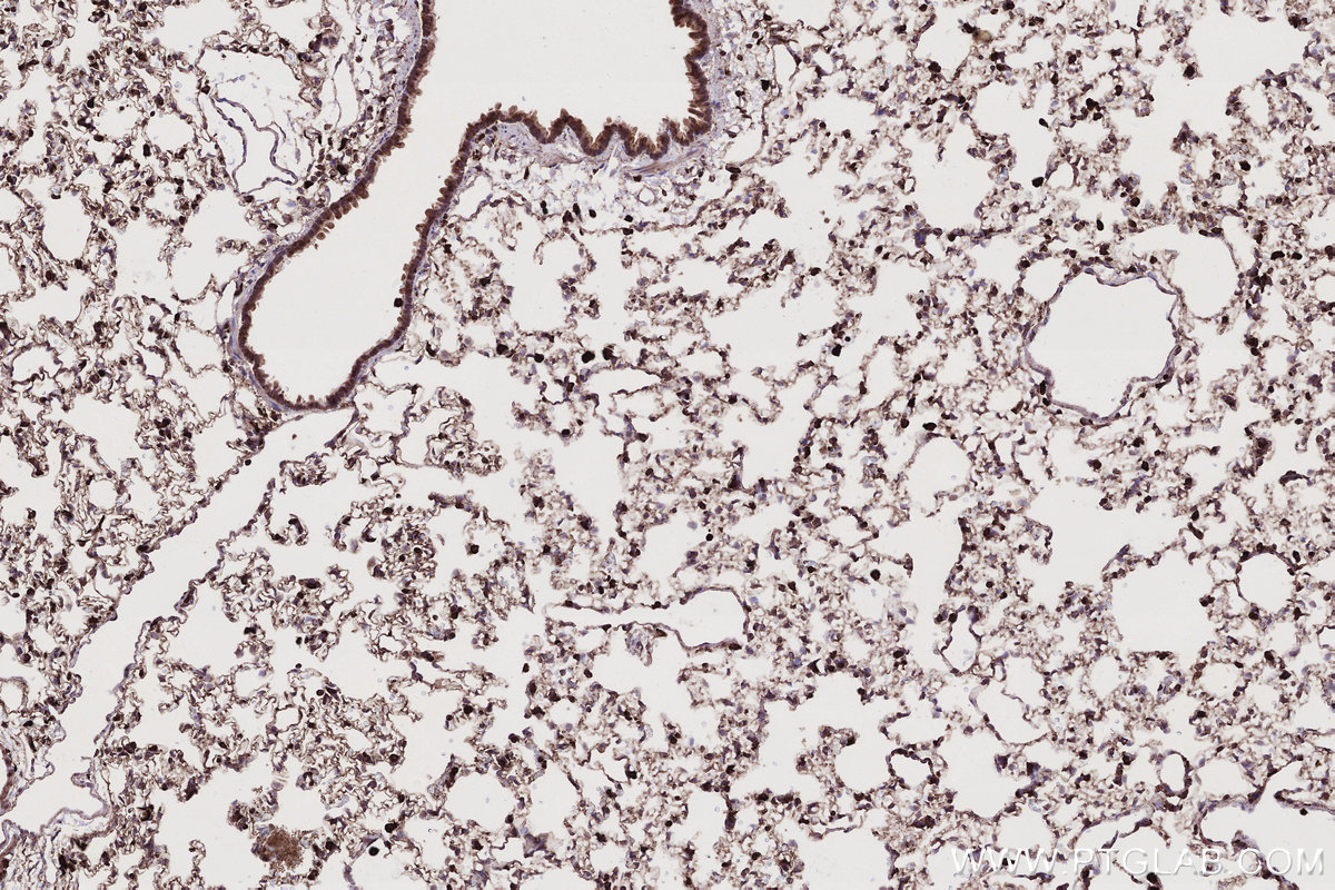 IHC staining of rat lung using 68186-1-Ig