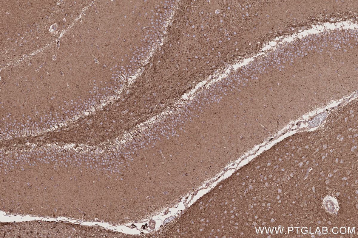 IHC staining of rat brain using 68186-1-Ig