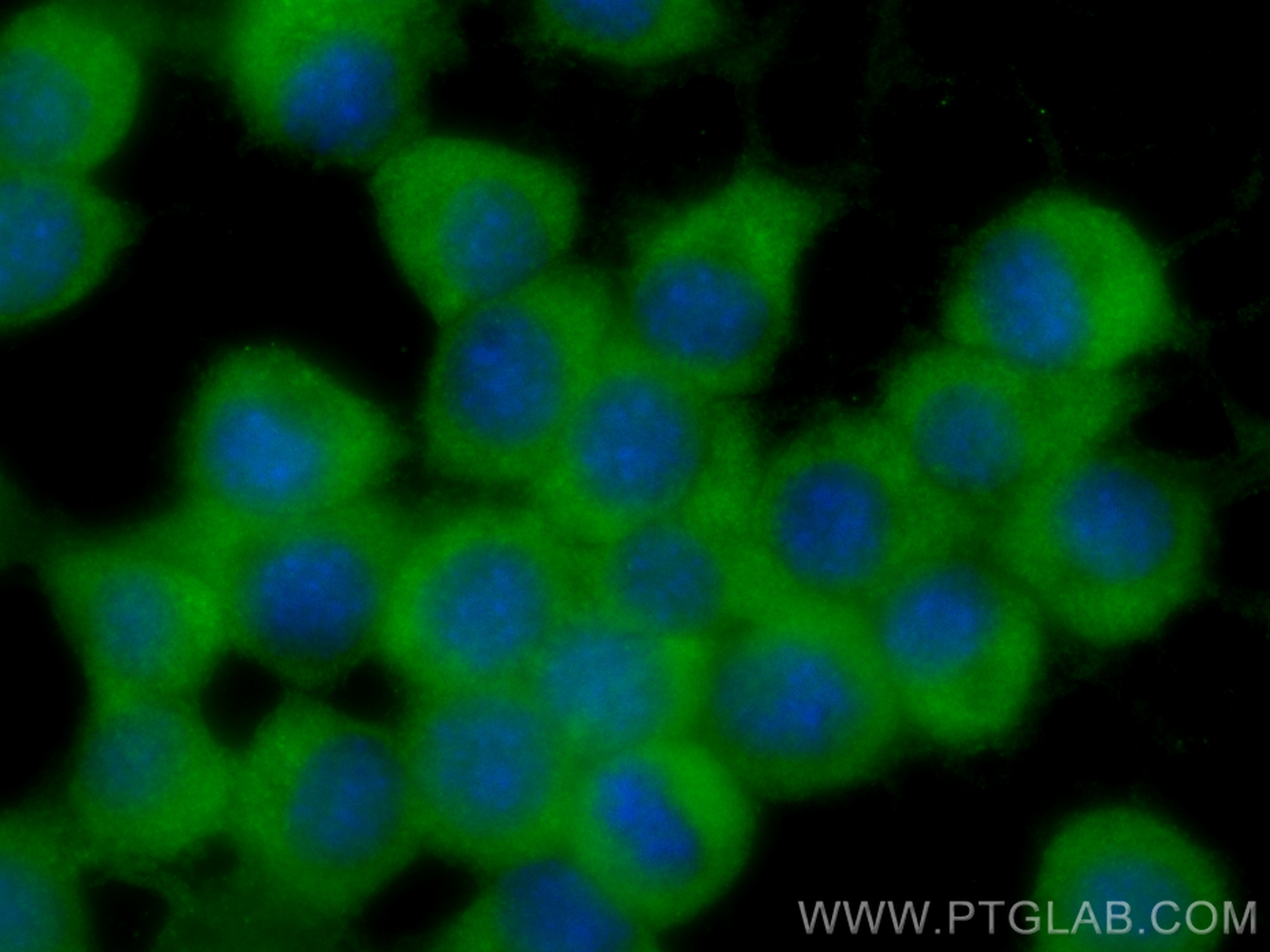 IF Staining of Neuro-2a using CL488-68186