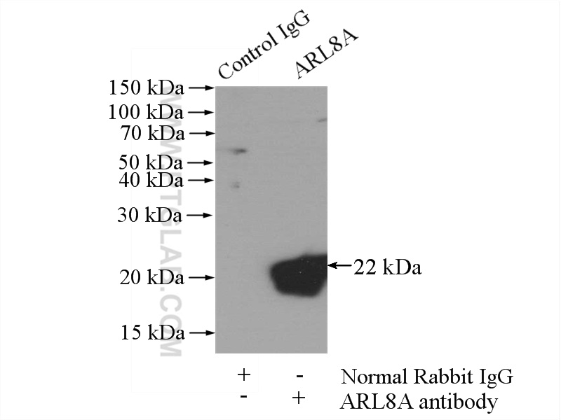 IP experiment of mouse brain using 17060-1-AP