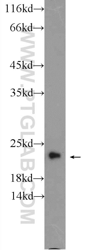 WB analysis of mouse brain using 17060-1-AP