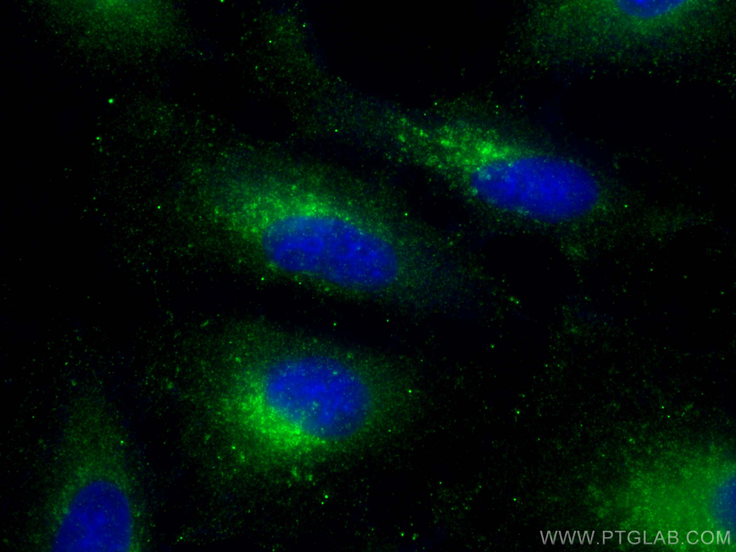 IF Staining of A549 using 13049-1-AP