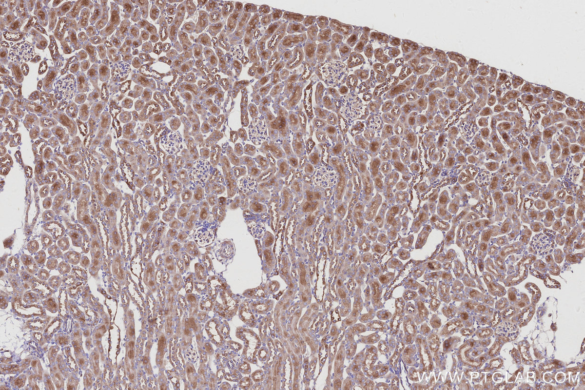 Immunohistochemical analysis of paraffin-embedded mouse kidney tissue slide using 13049-1-AP (ARL8B antibody) at dilution of 1:500 (under 10x lens). Heat mediated antigen retrieval with Tris-EDTA buffer (pH 9.0). IHC staining of mouse kidney using 13049-1-AP