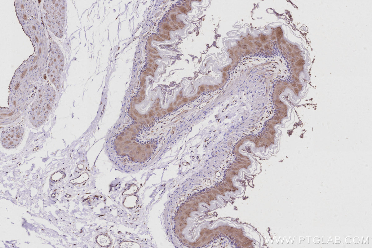 IHC staining of rat stomach using 13049-1-AP