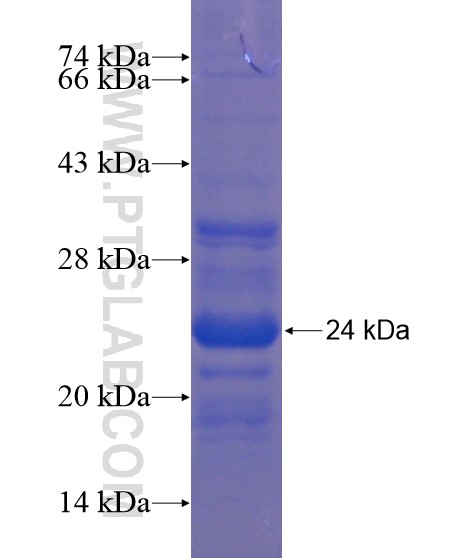 ARL8B fusion protein Ag18758 SDS-PAGE ARL8B fusion protein Ag18758 SDS-PAGE