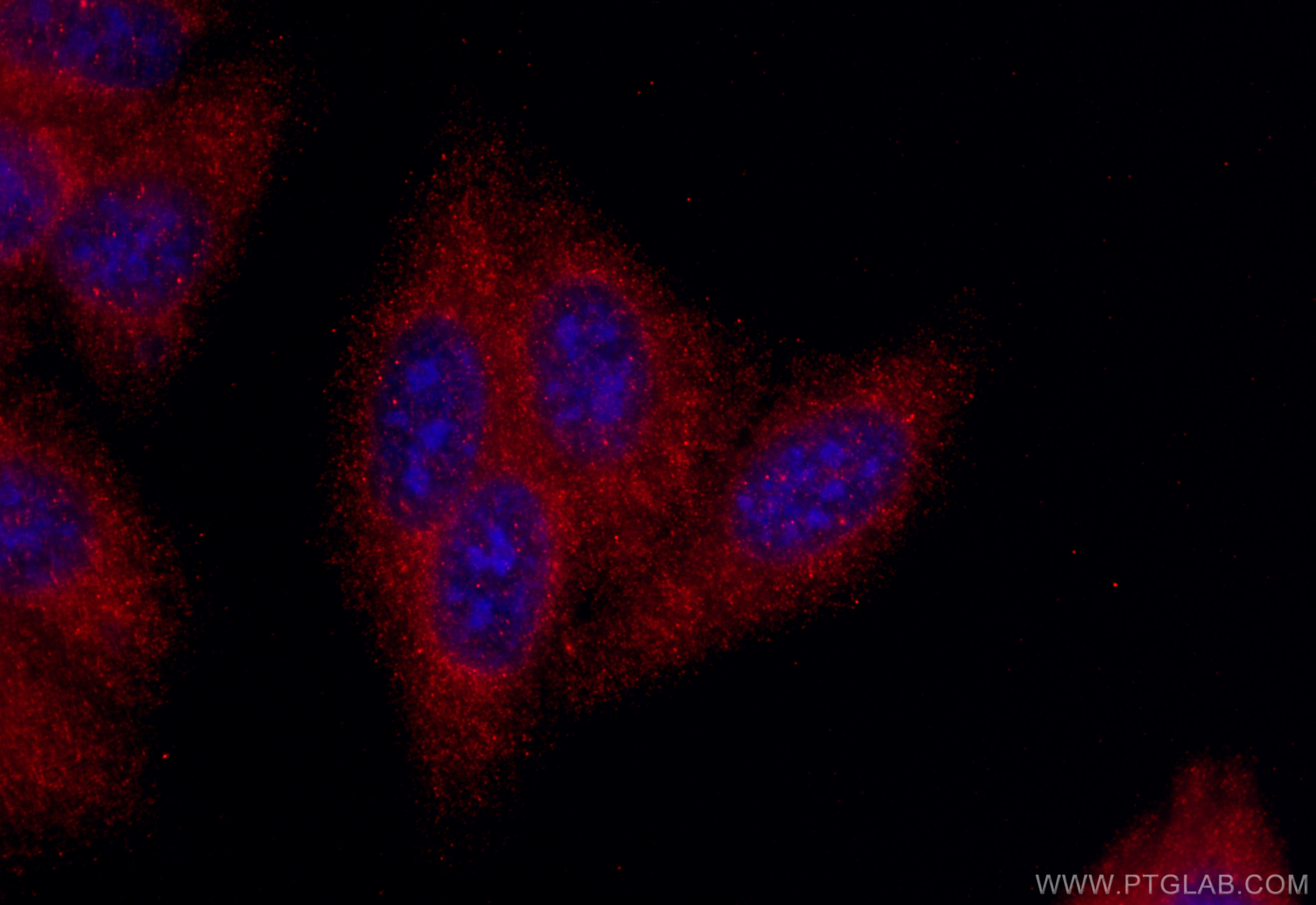 IF Staining of HepG2 using 20506-1-AP