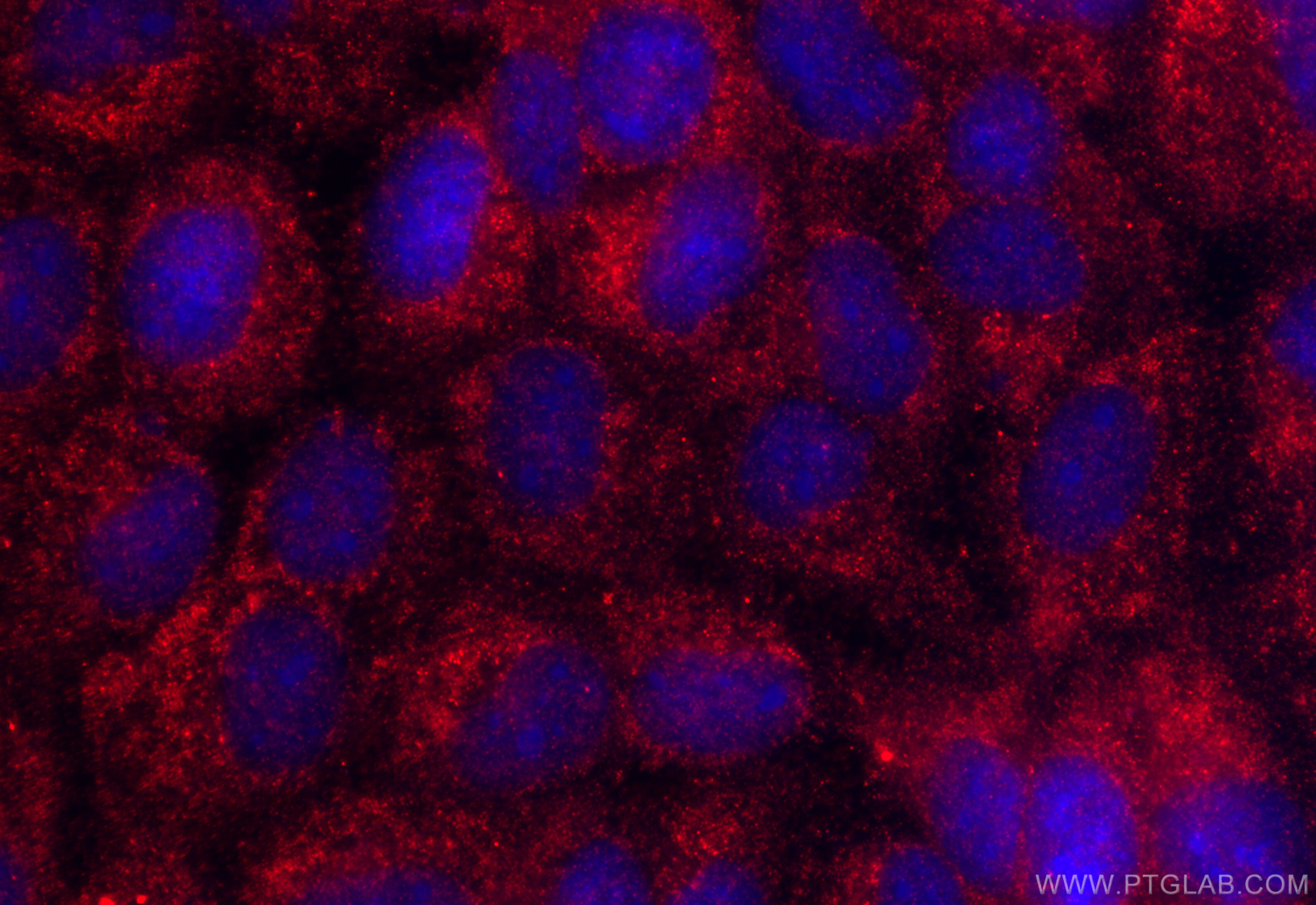 IF Staining of A431 using 20506-1-AP