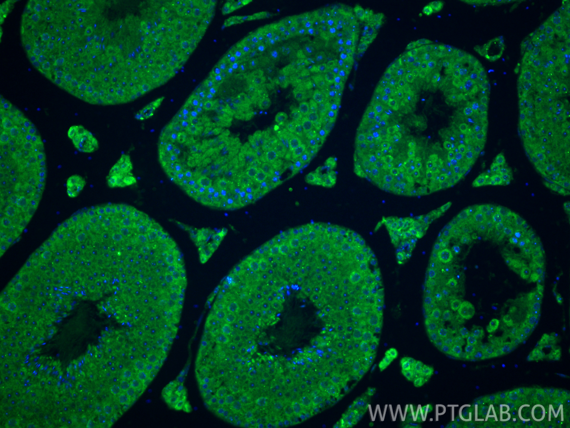 IF Staining of mouse testis using 24011-1-AP (same clone as 24011-1-PBS) IF Staining of mouse testis using 24011-1-AP (same clone as 24011-1-PBS)