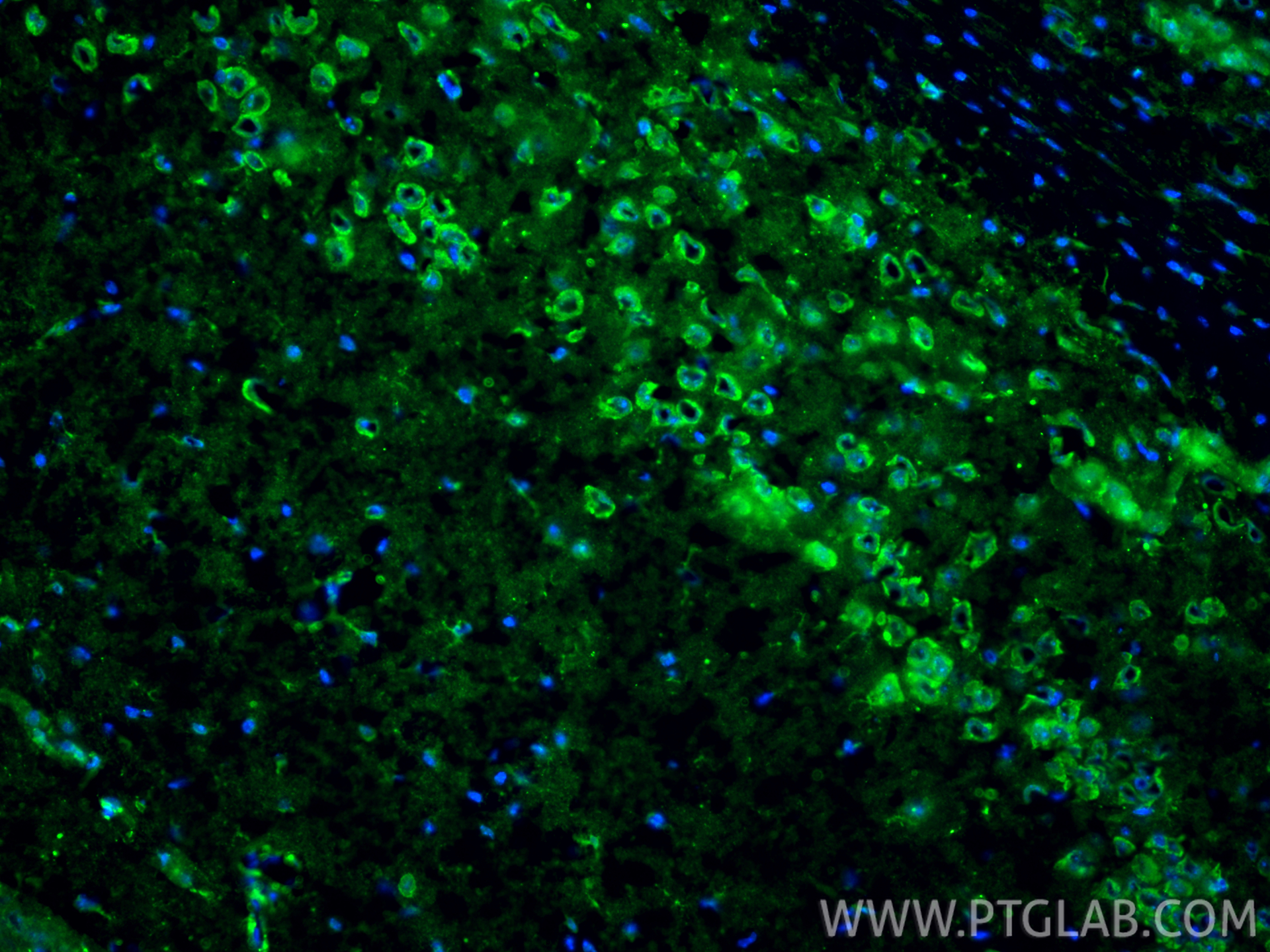 IF Staining of mouse brain using 24011-1-AP (same clone as 24011-1-PBS) IF Staining of mouse brain using 24011-1-AP (same clone as 24011-1-PBS)