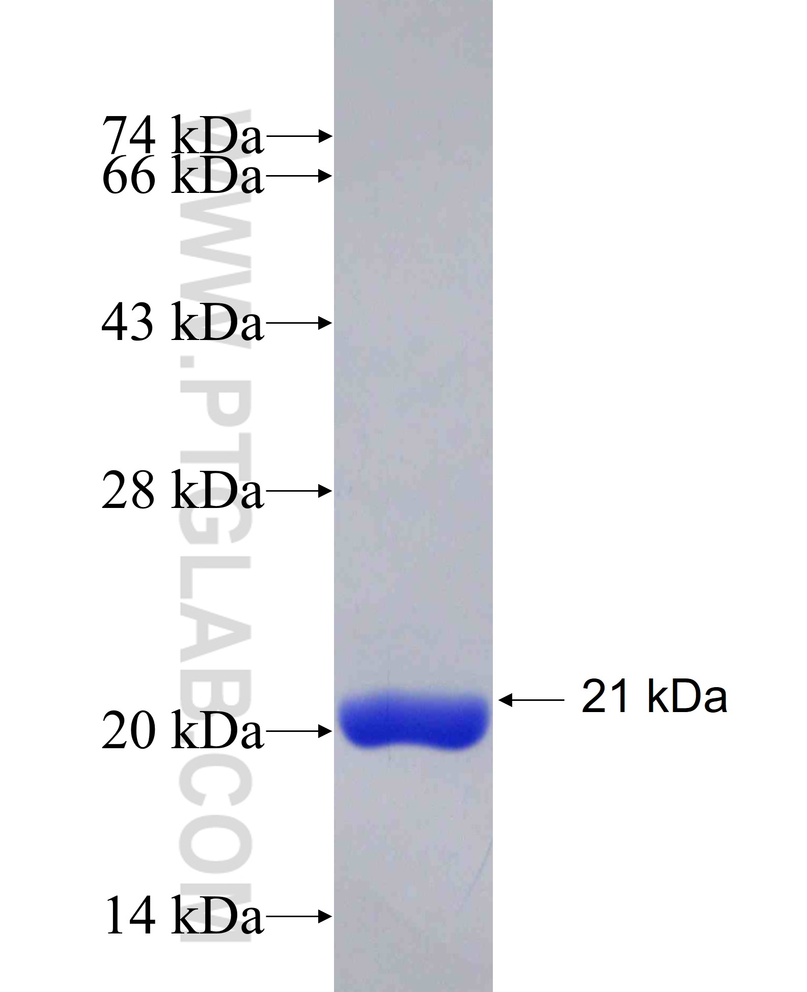 ARMC3 fusion protein Ag29278 SDS-PAGE