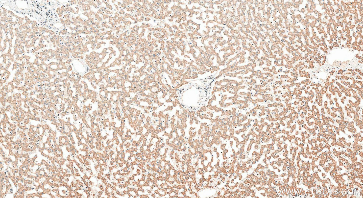 IHC staining of human liver using 24833-1-AP IHC staining of human liver using 24833-1-AP