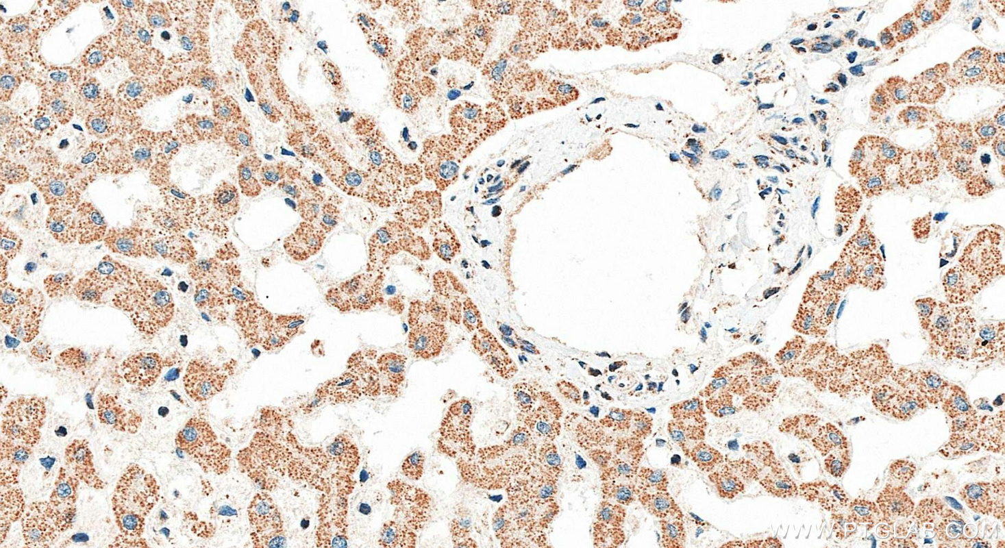 IHC staining of human liver using 24833-1-AP IHC staining of human liver using 24833-1-AP
