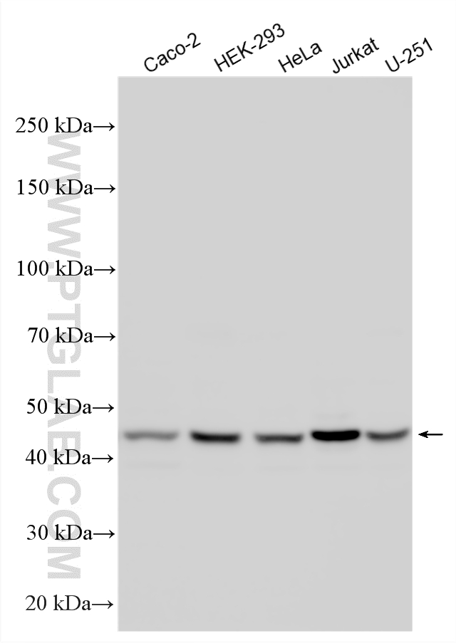 Various lysates were subjected to SDS PAGE followed by western blot with 25558-1-AP (ARMC6 antibody) at dilution of 1:20000 incubated at room temperature for 1.5 hours. WB analysis using 25558-1-AP