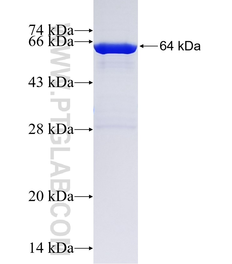 ARMC6 fusion protein Ag22278 SDS-PAGE