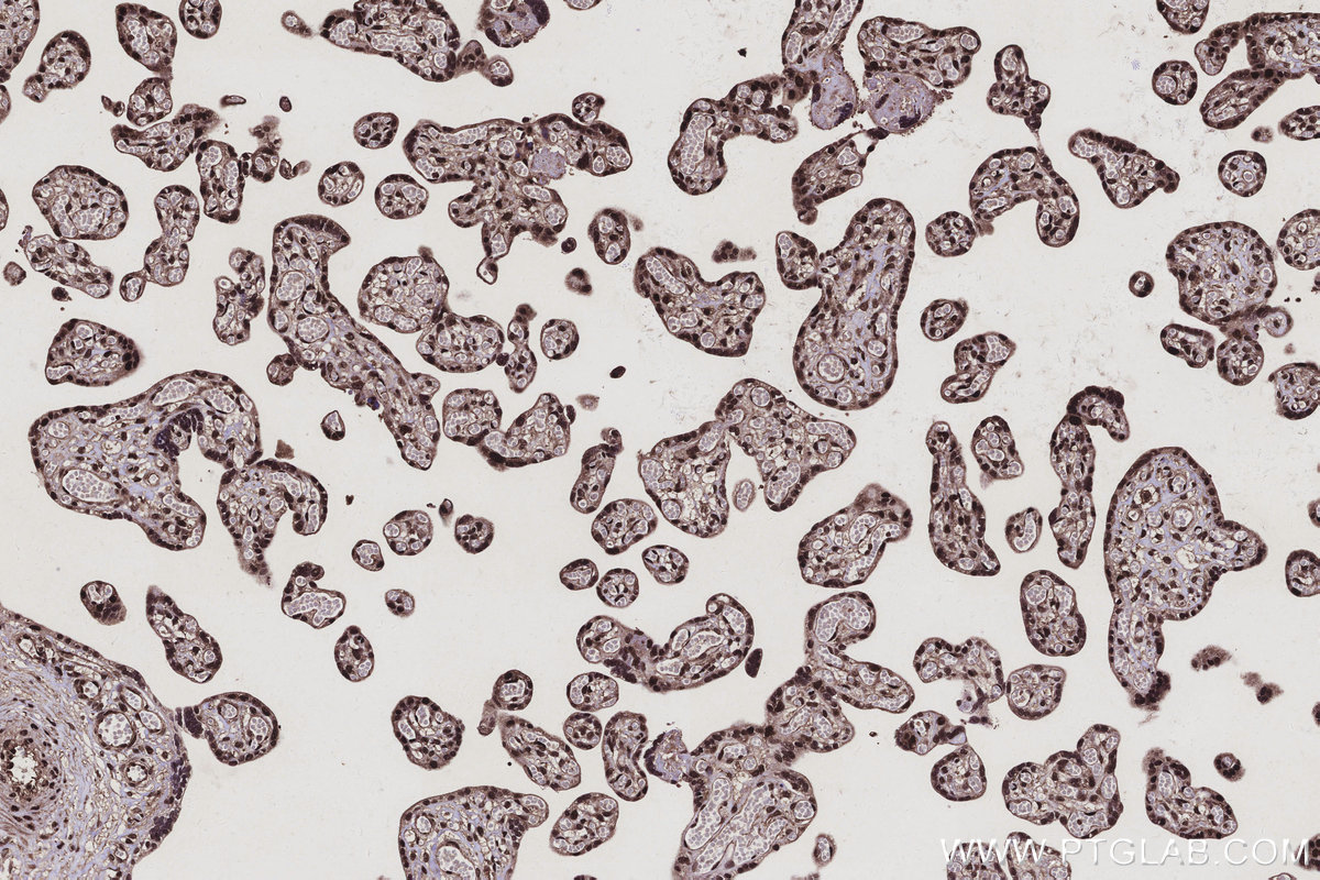 IHC staining of human placenta using 25705-1-AP