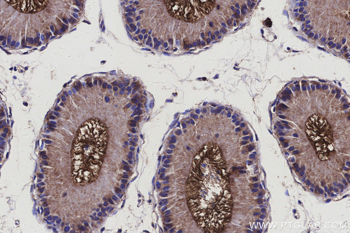 IHC staining of mouse epididymis using 25705-1-AP