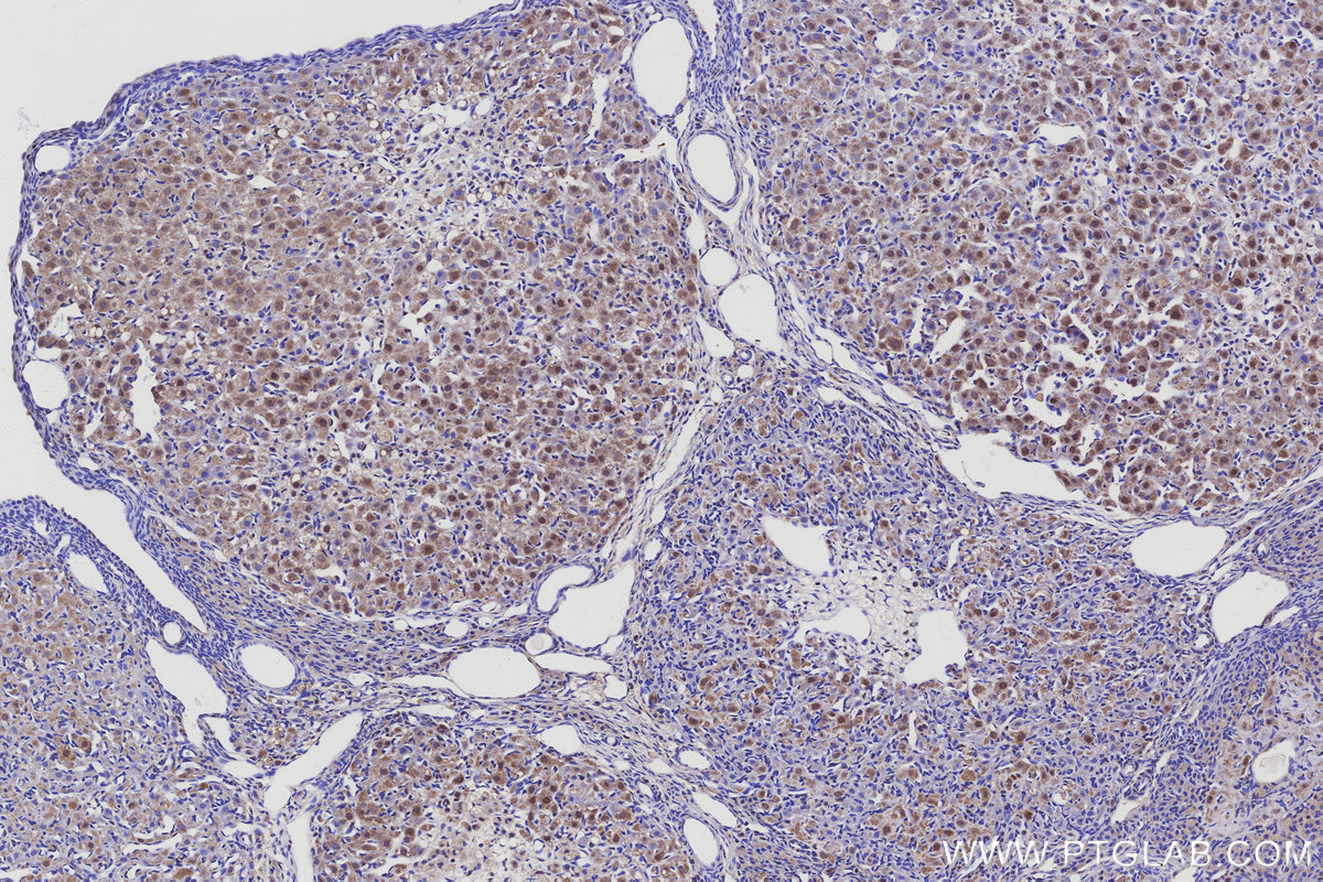 IHC staining of rat ovary using 25705-1-AP