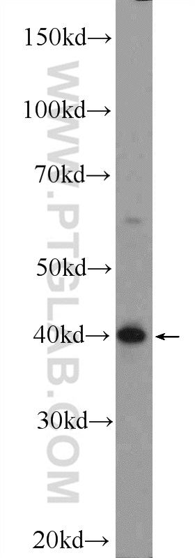 WB analysis of mouse brain using 25705-1-AP