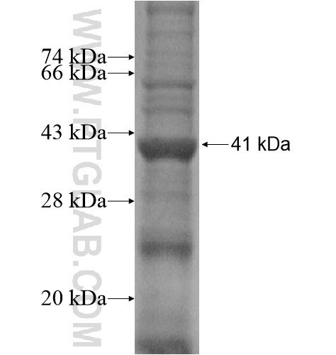 ARMCX4 fusion protein Ag15780 SDS-PAGE ARMCX4 fusion protein Ag15780 SDS-PAGE