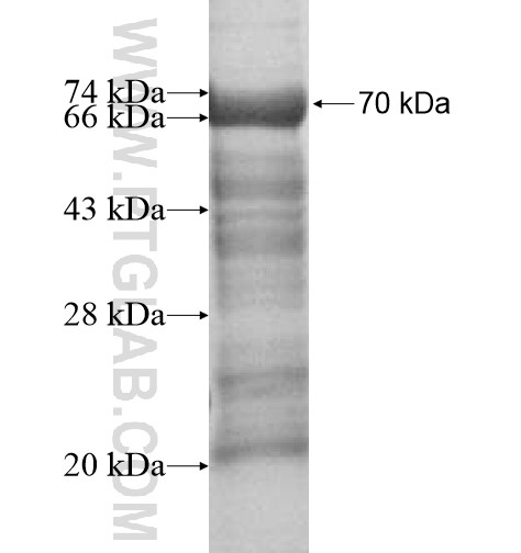 ARMCX6 fusion protein Ag14804 SDS-PAGE ARMCX6 fusion protein Ag14804 SDS-PAGE