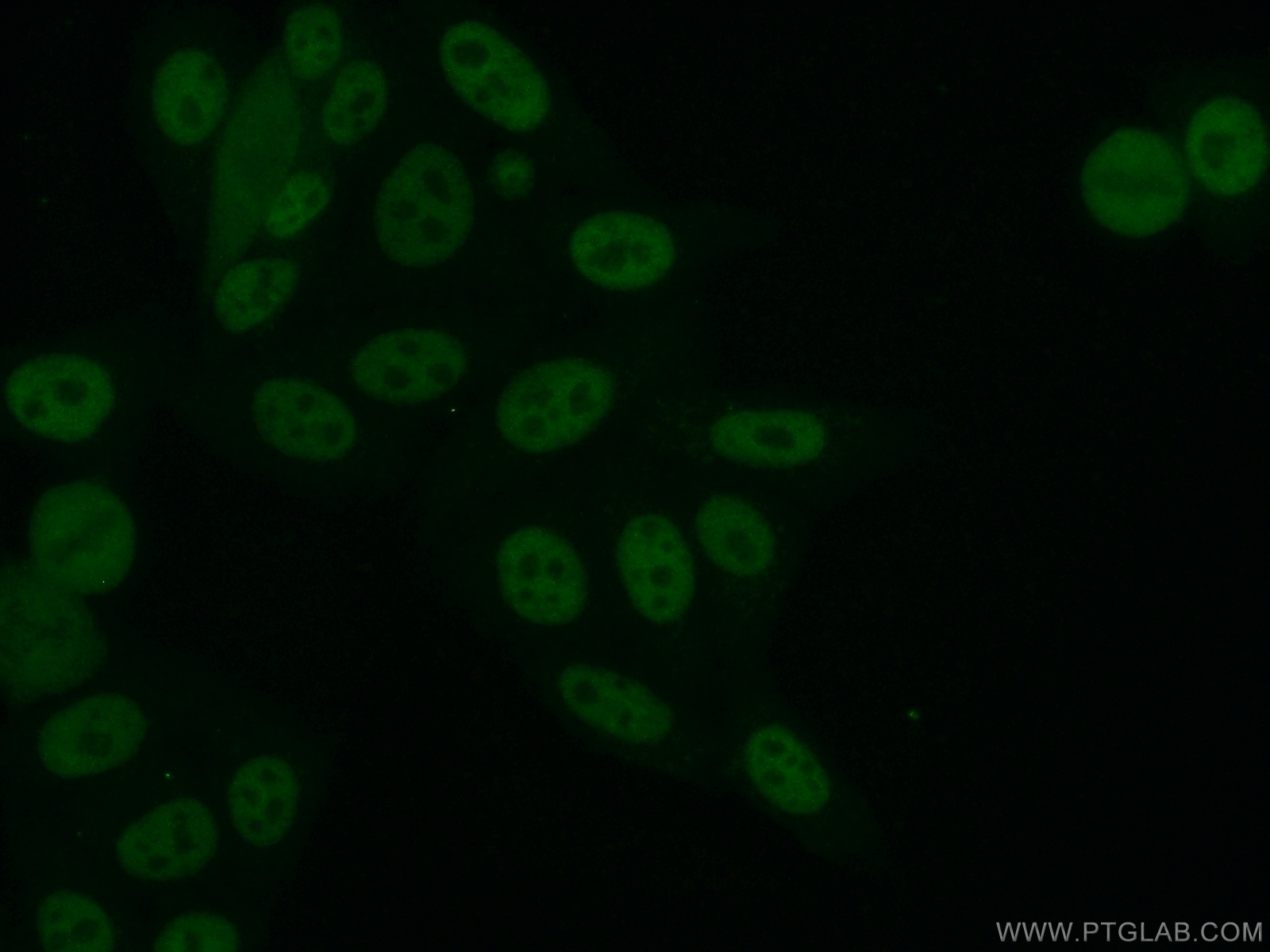 IF Staining of HepG2 using 14105-1-AP