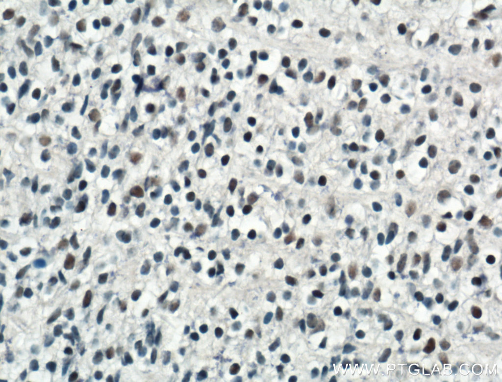 IHC staining of mouse embryo using 14105-1-AP