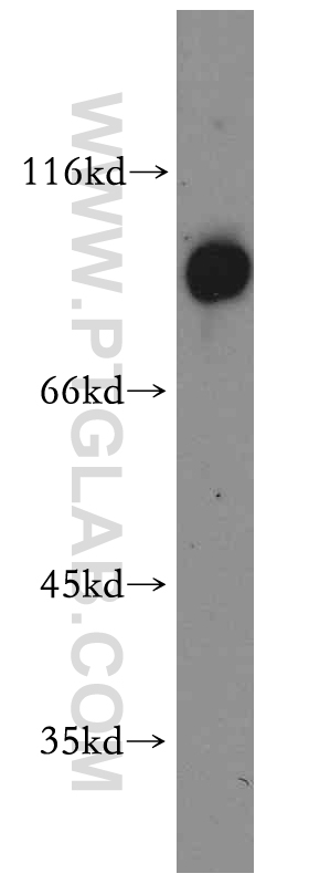 ARNT,HIF1B Polyclonal antibody