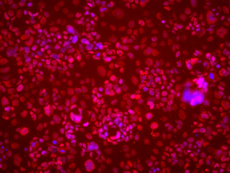 IF Staining of HT-1376 using 66732-1-Ig