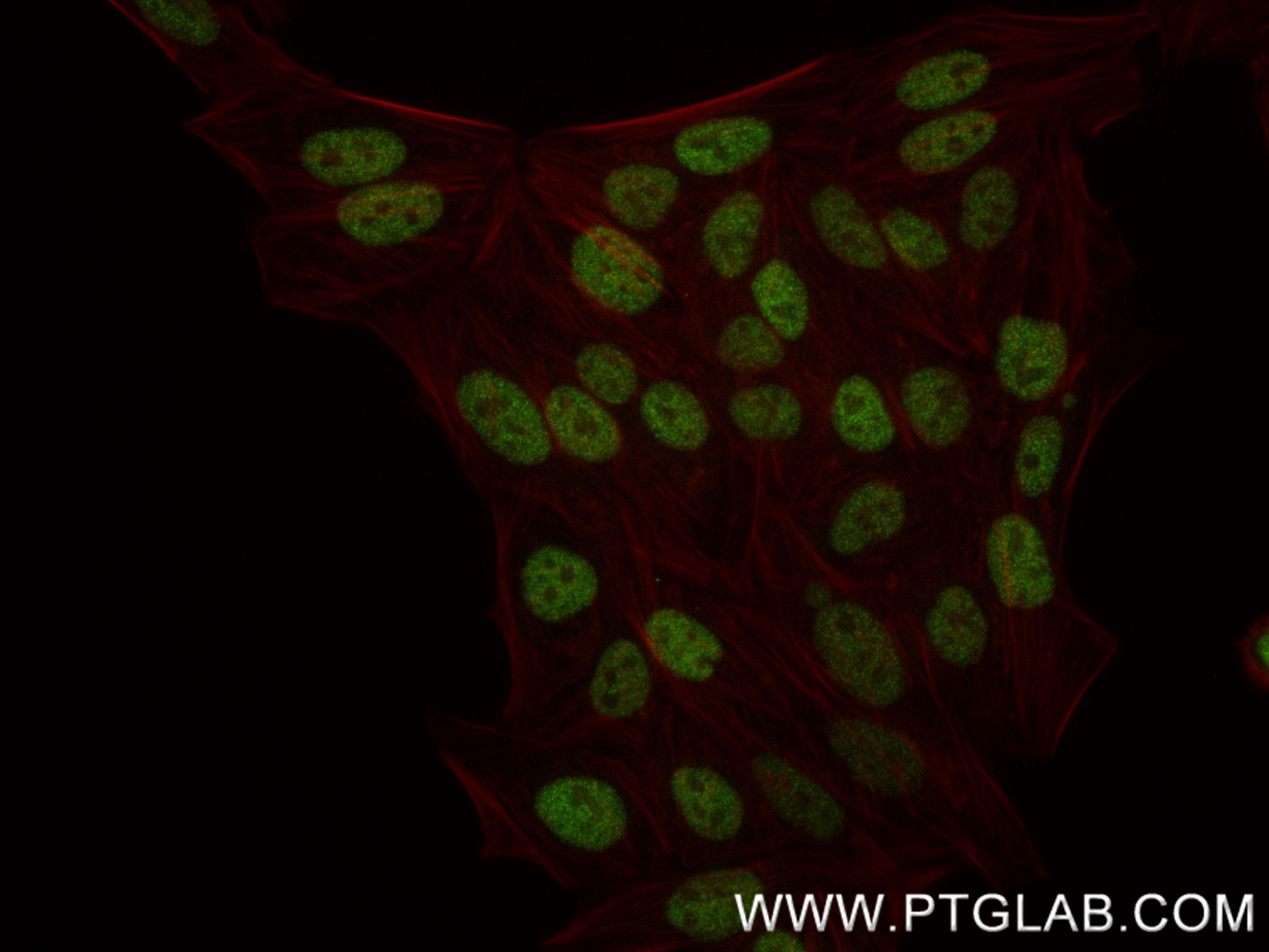 IF Staining of HepG2 using 84650-4-RR