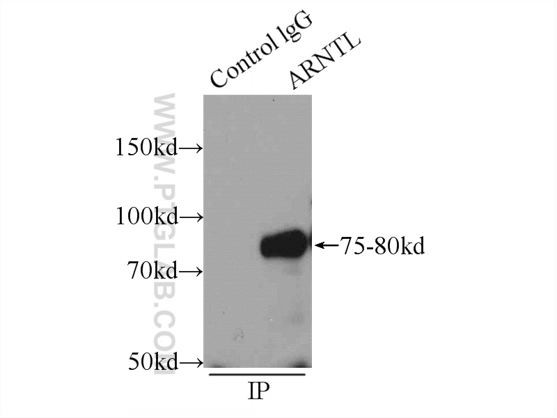 IP experiment of HeLa using 14268-1-AP