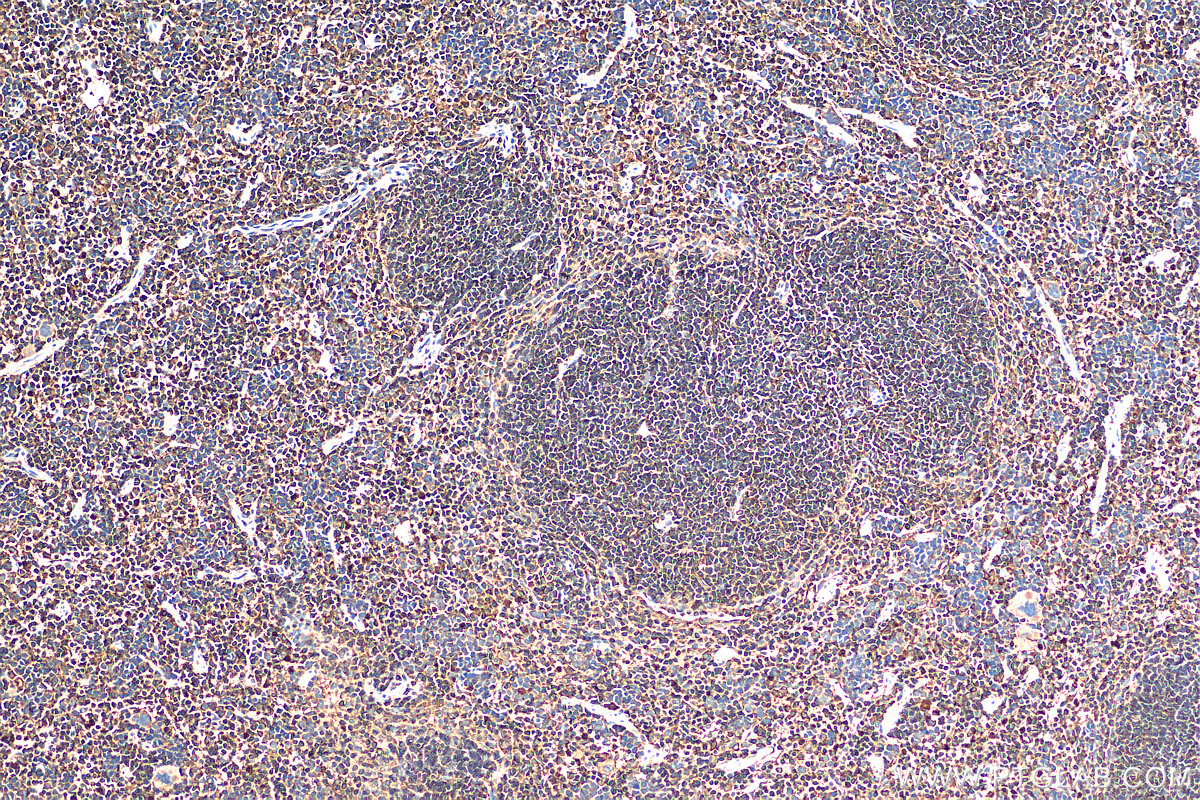 IHC staining of mouse spleen using 28368-1-AP