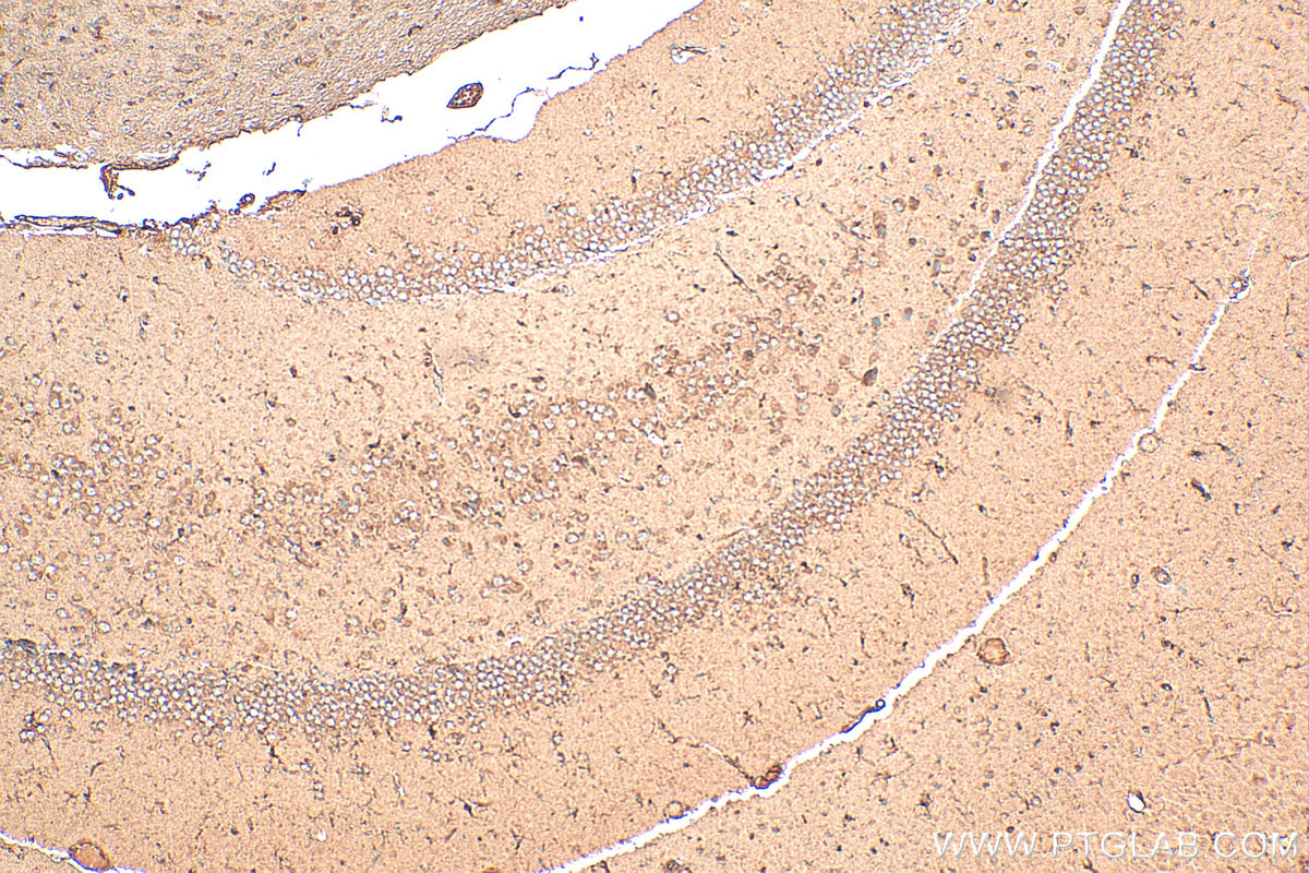 Immunohistochemical analysis of paraffin-embedded mouse brain tissue slide using 28368-1-AP (ARPC1B antibody) at dilution of 1:400 (under 10x lens). Heat mediated antigen retrieval with Tris-EDTA buffer (pH 9.0). IHC staining of mouse brain using 28368-1-AP