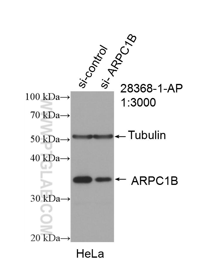 WB analysis of HeLa using 28368-1-AP