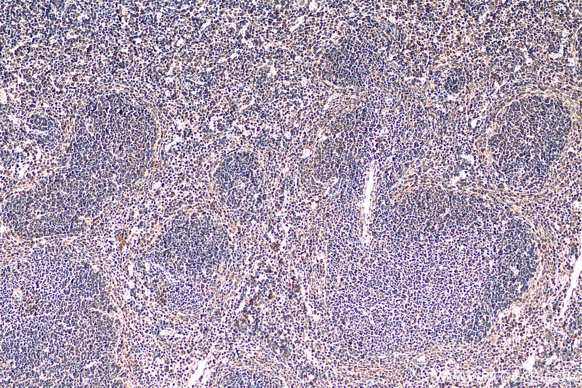 IHC staining of mouse spleen using 67320-1-Ig