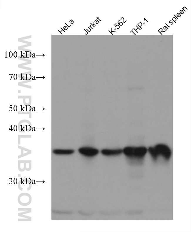 ARPC1B