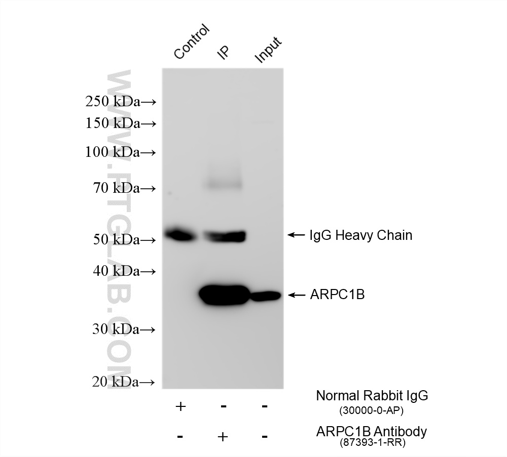 IP experiment of HeLa using 87393-1-RR