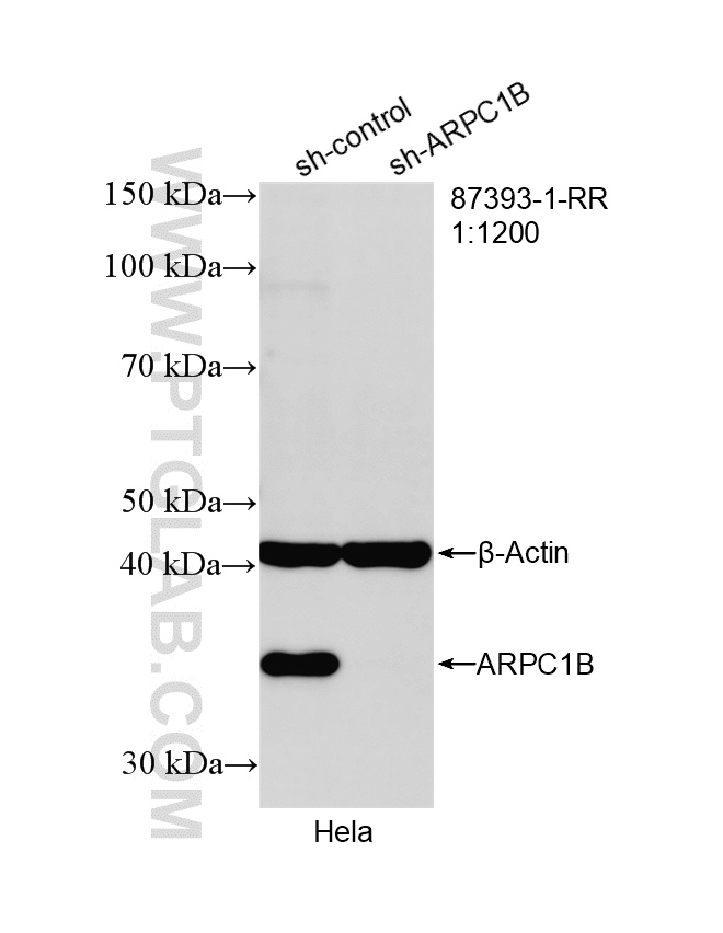 WB analysis of HeLa using 87393-1-RR