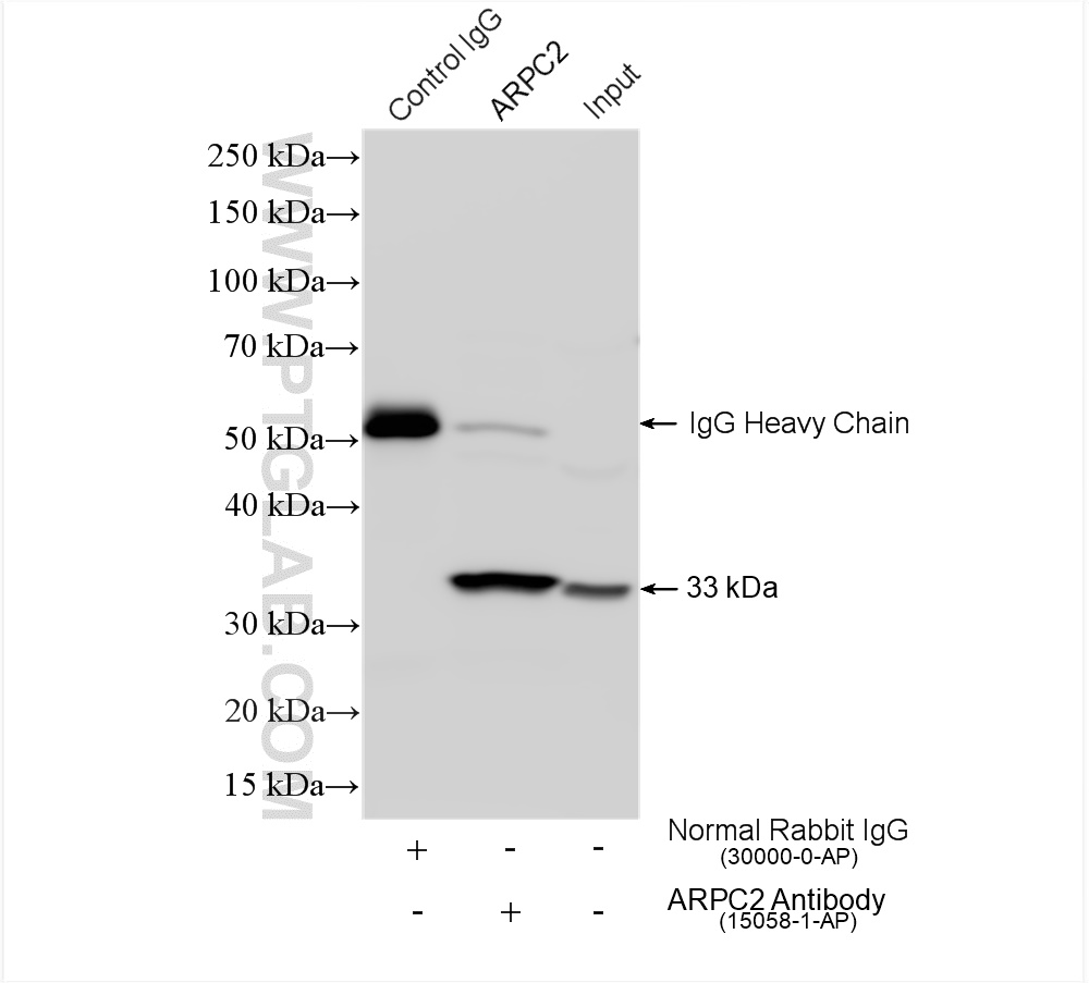 IP experiment of HeLa using 15058-1-AP