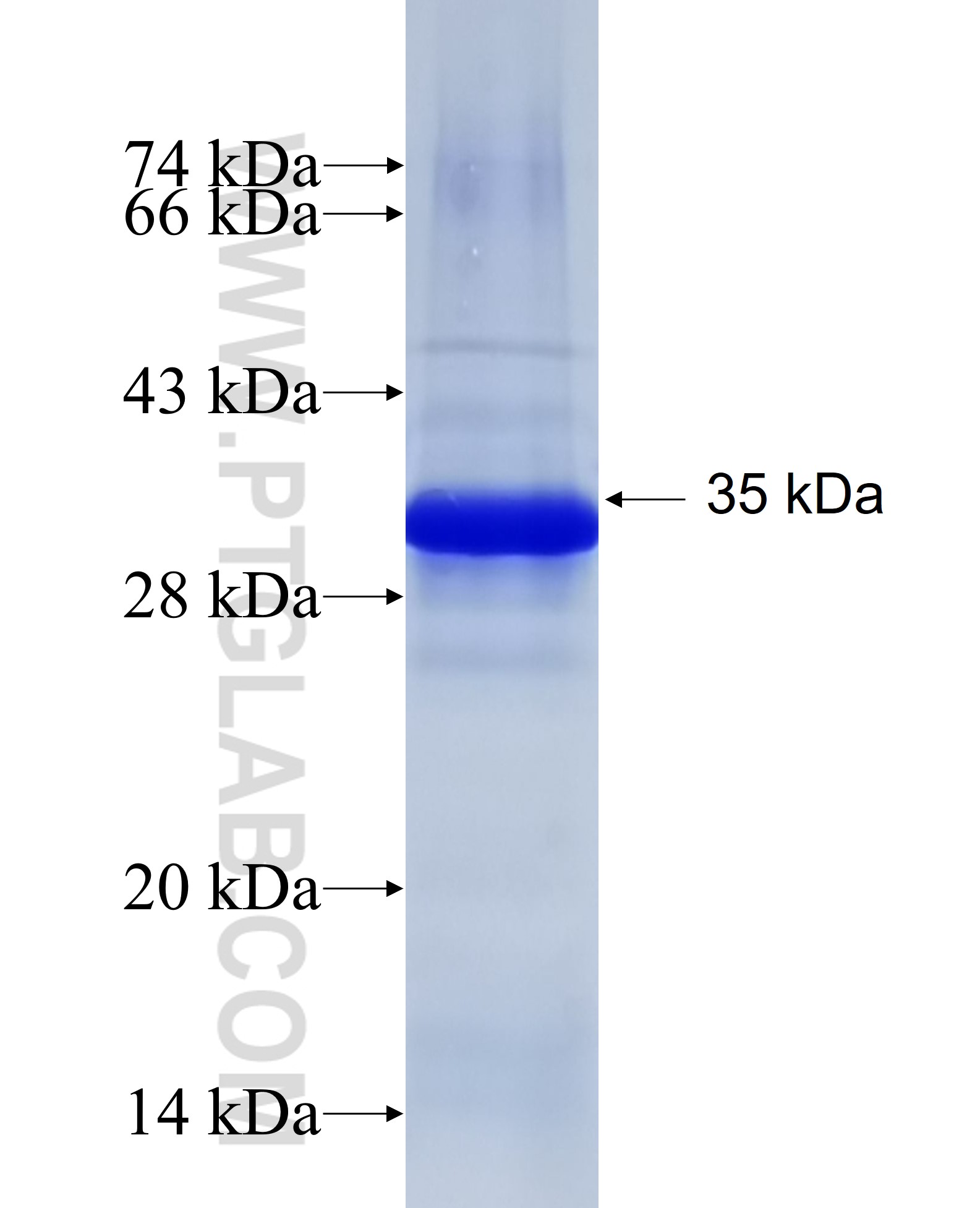 ARPC2 fusion protein Ag7082 SDS-PAGE