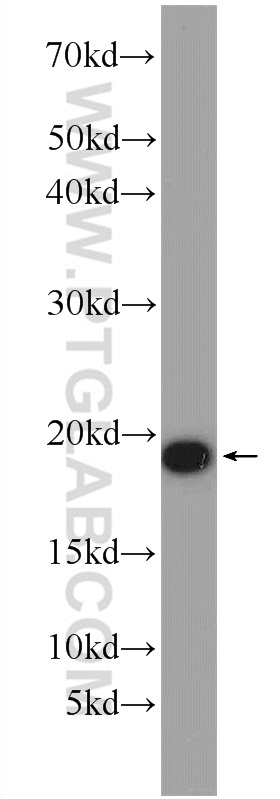 WB analysis of mouse brain using 10930-1-AP