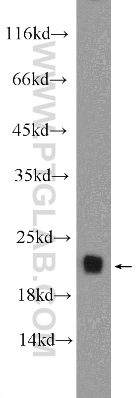 WB analysis of mouse brain using 16717-1-AP