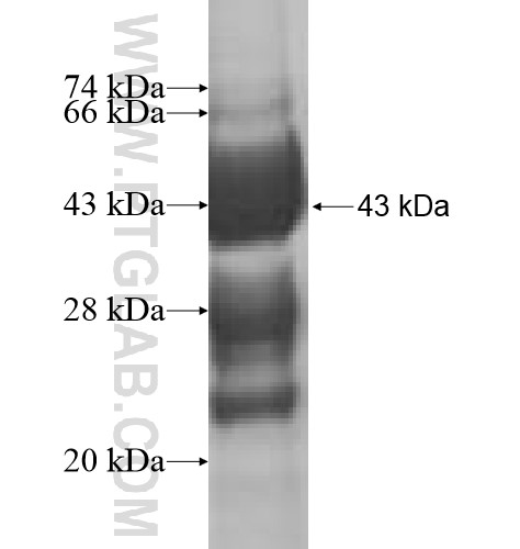 ARPC5 fusion protein Ag10144 SDS-PAGE