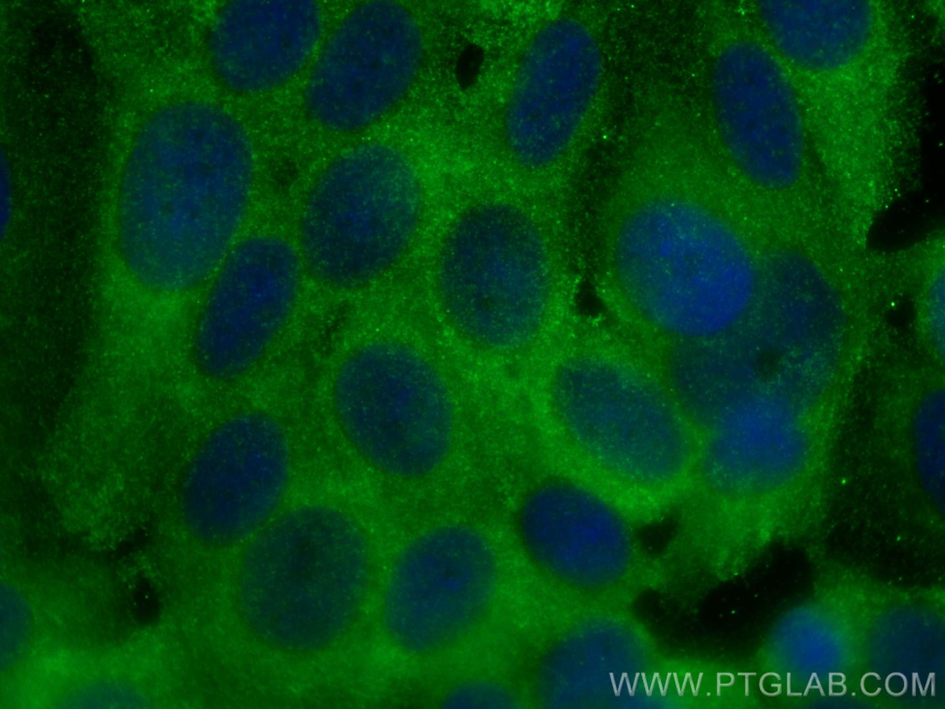 Immunofluorescent analysis of (-20°C Methanol) fixed MCF-7 cells using ARPC5L antibody (22025-1-AP) at dilution of 1:400 and CoraLite®488-Conjugated AffiniPure Goat Anti-Rabbit IgG(H+L). IF Staining of MCF-7 using 22025-1-AP