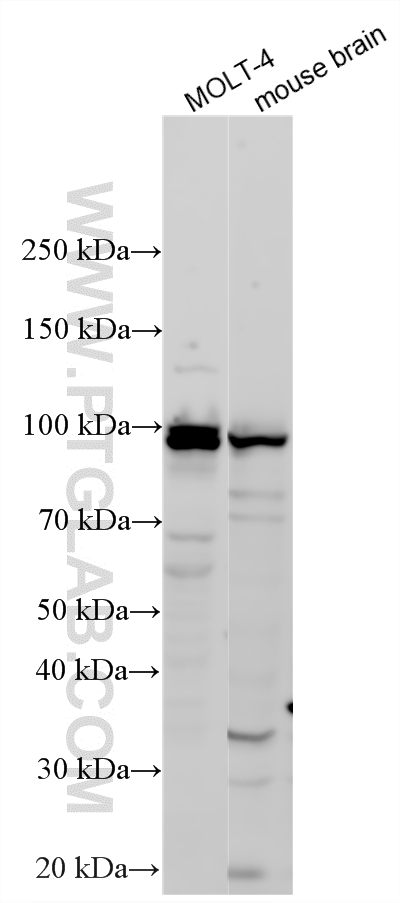 WB analysis using 11829-1-AP