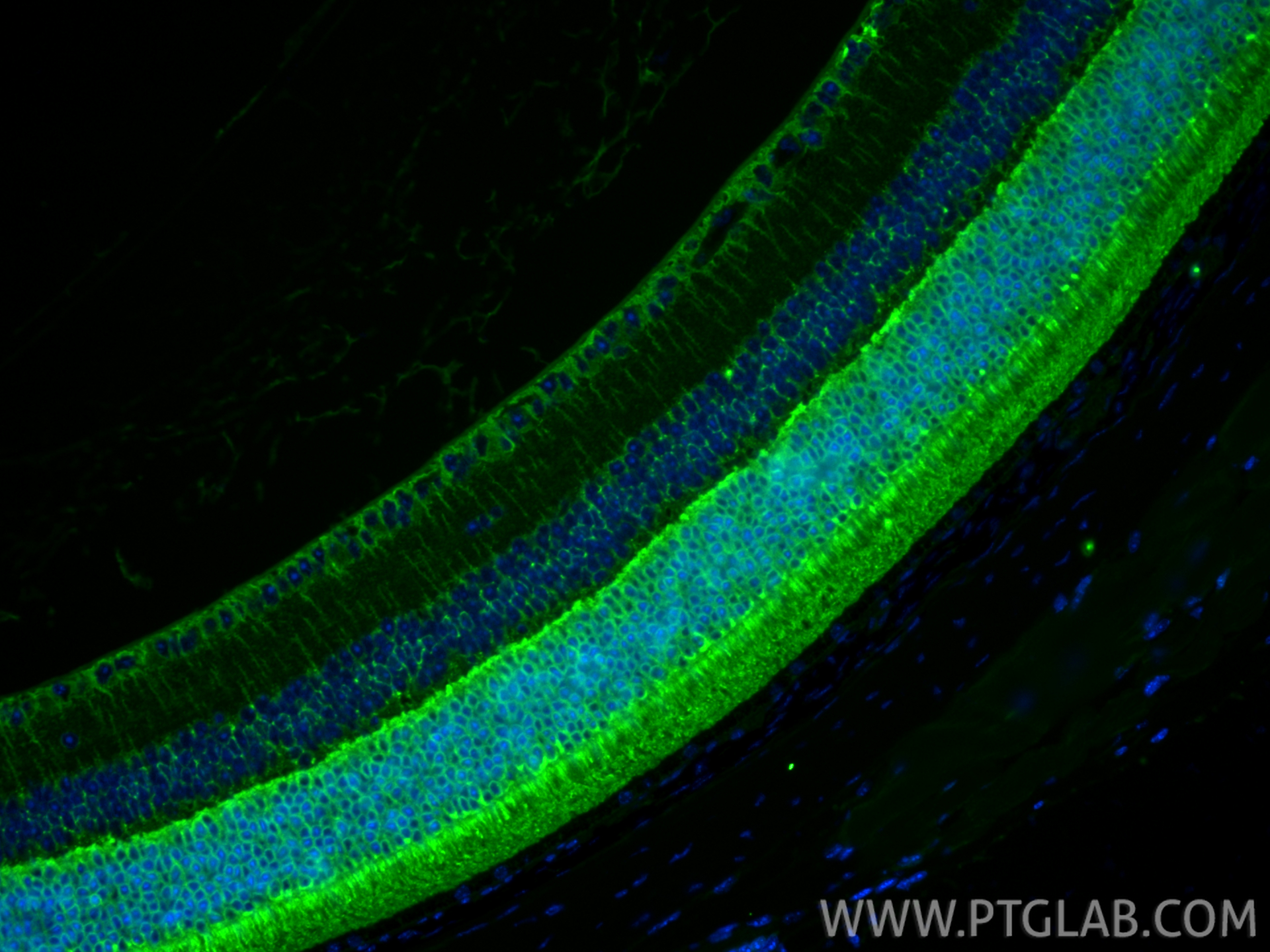IF Staining of mouse eye using 11100-2-AP IF Staining of mouse eye using 11100-2-AP