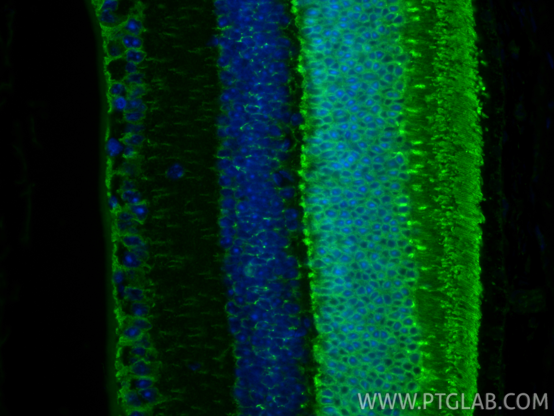 IF Staining of mouse eye using 11100-2-AP IF Staining of mouse eye using 11100-2-AP