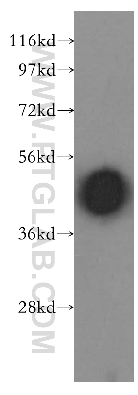 Arrestin C Polyclonal antibody