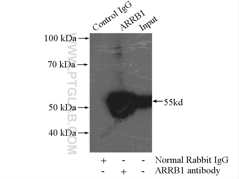 IP experiment of mouse lung using 15361-1-AP