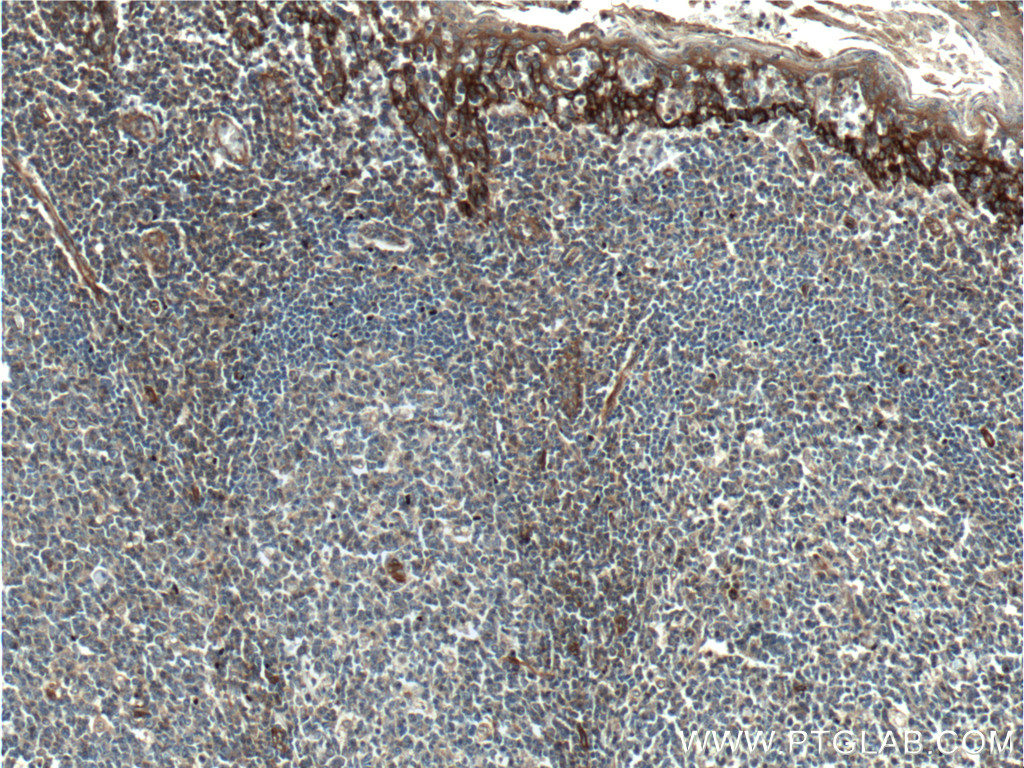 IHC staining of human tonsil using 10171-1-AP