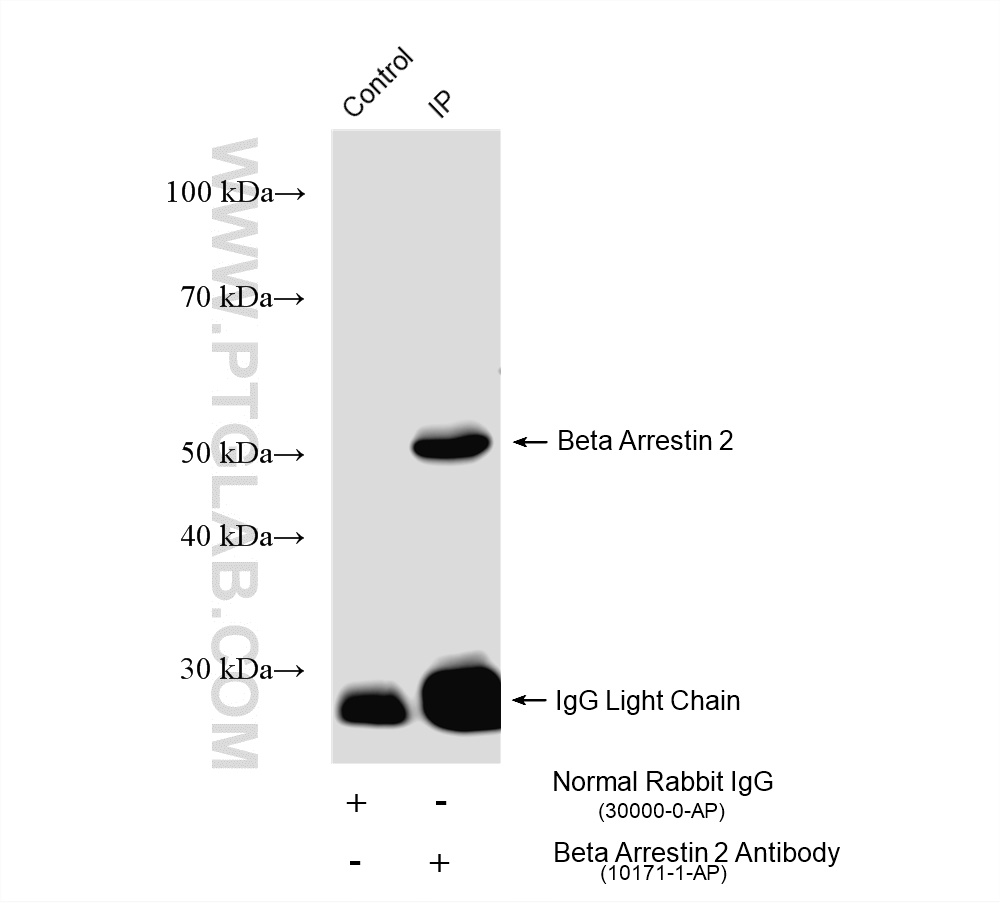 IP experiment of mouse brain using 10171-1-AP
